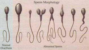 Sperm Morphology Types
