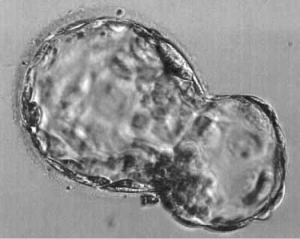 hatching blastocyst