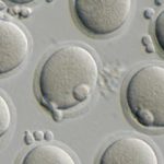 IVF egg retrieval and best test for ovarian reserve