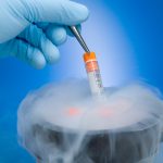 Frozen Embryo Transfer
