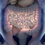 gut microbes and causes of infertility