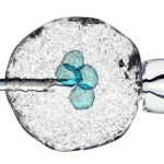 Which Protocol is Best With a Frozen Embryo Transfer Cycle?