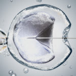 Has IVF Become Safer or Easier to Undergo Than in the Past?