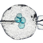 When to Consider IVF