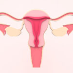 Can Uterine Polyps Cause Infertility?