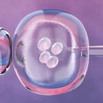 Supplementing IVF Cycles With Progesterone