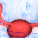 Uterine Causes of Recurrent Pregnancy Loss