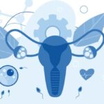 What To Expect With an HSG
