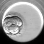 Embryoscope
