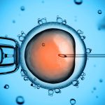 why choose elective single embryo transfer