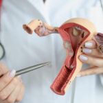 fallopian tube