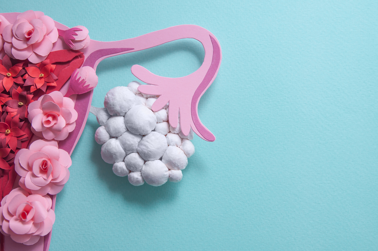Success Rates of IVF with PCOS