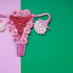 The Most Common Questions About PCOS and Infertility