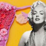 Endometriosis and Infertility: Lessons from Marilyn Monroe